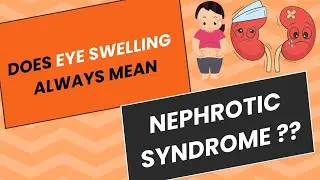 DOES EYE SWELLING ALWAYS MEAN NEPHROTIC SYNDROME ? | AAKHON ME SUJAN | DR.KUNAL PAI