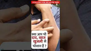 Daad aur khujli ko jarh se khatam karenडैड और खुजली को जार से ख़त्म करें