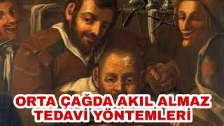 Orta Çağ'da Yara Tedavisinde Uygulanan AKIL ALMAZ Tedavi Yöntemleri !