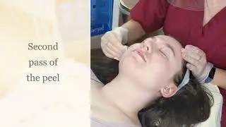 Obagi Blue Radiance Peel at Authentic Aesthetics