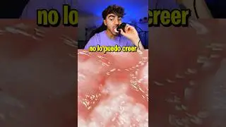 Así se ve mi lengua bajo un microscopio 😱