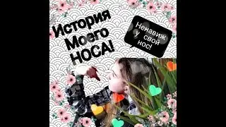 ИСТОРИЯ МОЕГО НОСА/ПОЧЕМУ НЕНАВИЖУ СВОЙ НОС