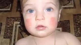 Skincup