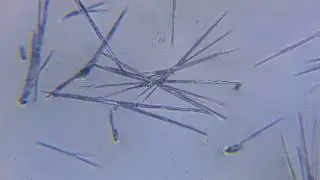 Crystals growing under a microscope