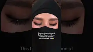 Central heterochromia 👁👁 