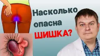Шишка в заднем проходе. Выпала и болит. ЧТО ДЕЛАТЬ?