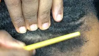 Asmr cornrow and scalp nitpicking