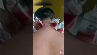 Terapi BEKAM