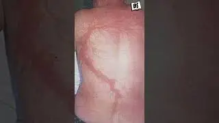 Este HOMBRE SOBREVIVIÓ a 7 RAYOS #shorts #curiosidades