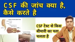 What is CSF Test, its Use Report Procedure and When it Recommended (CEREBROSPINAL FLIUD TEST)