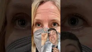 What The EYES Say About Your Health 