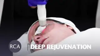 Deep Rejuvenation Laser Skin Treatment - Laser Genesis for Redness, Rosacea  and coarse pores