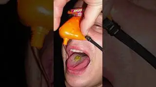 Конфета "Носовой шланг". Самые отвратительные сладости в мире.