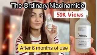 The Ordinary Niacinamide 10 + zinc 1 Review/ WHAT ARE THE RESULTS after 6 months of USE??