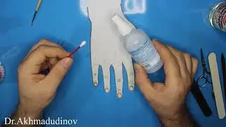 Treatment of nail fungus is inexpensive and effective (Onychomycosis) Akhmadudinov A.M.