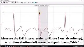 Lab Procedures Video- Heart EKG- FINAL