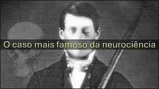 O caso Phineas Gage