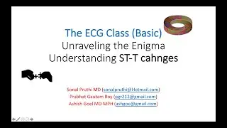 The ECG Class (Basics) - 7 - Understanding ST-T changes