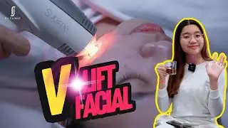Vlift facial treatment experience at RJ Clinic | Julian