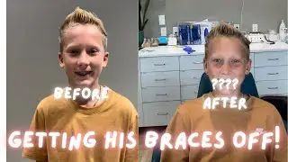 Braces are off and Packing dance bags!