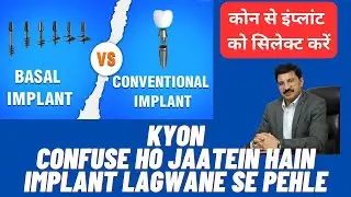 How to Fix New Teeth With Basal Implants? Dr. Praveen Bhatia #teeth #implants