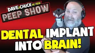 Dental Implant Into Brain!