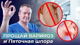 Осторожно, ПЯТОЧНАЯ ШПОРА! Как СНЯТЬ ОСТРУЮ БОЛЬ и даже УБРАТЬ ВАРИКОЗ за 2 месяца?