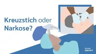 Kreuzstich oder Vollnarkose? 🤓  | besser operiert