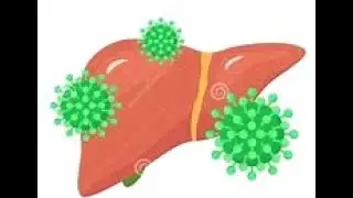 Herpes Liver Failure in Pregnancy_Brief Overview