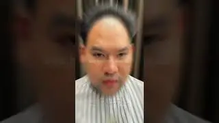 Sebelum dan setelah melakukan pemasangan toupee bagian depan  #barbershop #toupeepria #hairsystem