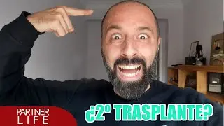 ¿2º TRASPLANTE DE PELO?