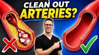 What is Vitamin K2? [Benefits, Sources & Best Food For Blood Flow]