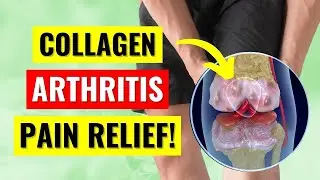 The Truth About Collagen for Arthritis Pain