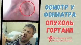 Осмотр  гортани NBI-эндоскопом  в специальном сине-зеленом свете