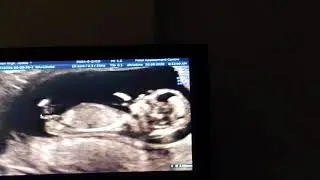 Gender Reveal Ultrasound! | Baby #2!