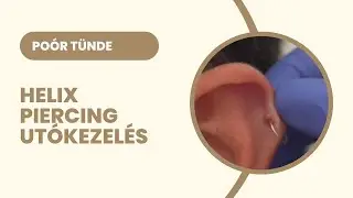 Hólyag a helix piercing körül