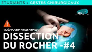 Dissection du Rocher Tutoriel | Partie #4
