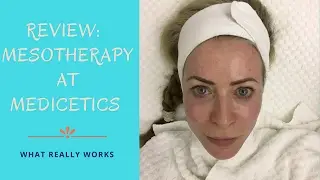 Review of Mesotherapy treatment at Medicetics clinic