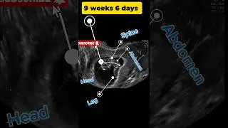 Pregnancy Week 9 plus 6 days || Fetal Developments || ultrasound #baby  | ultrasound
