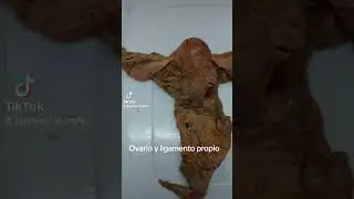 El ovario y el ligamento útero ovárico o propio del ovario