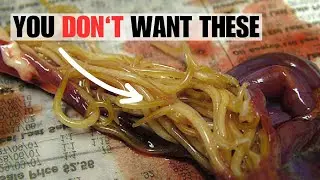 How to avoid Parasitic Worms?!