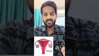 खून के आंसू 😱😳#periods #menstruation #viralvideo  #endometriosis #shorts    #trending #reels #doctor