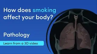 Smoking cause lung cancer | 3D medical video | MediMagic
