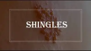 [Pediatrics] Infectious disease - Shingles symptoms, varicella zoster, investigation, treatment