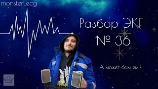 Разбор ЭКГ № 36 (запись стрима в телеграме)
