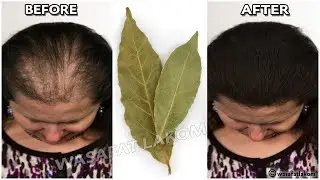 The Japanese secret , 🌿 to grow hair at a rocket speed and treat baldness from the first week