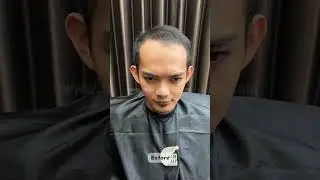 Sebelum dan sesudah menggunakan toupee bagian depan