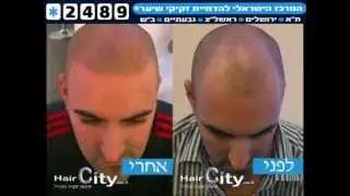 שיער מדומה לגבר קעקועי שיער הדמייה של Hair