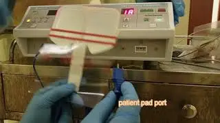 how to operate an  electrosurgical diathermy diathermy machine