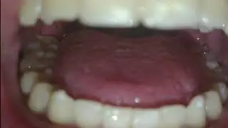 Eating you | VORE VIDEO | UVULA | MOUTH